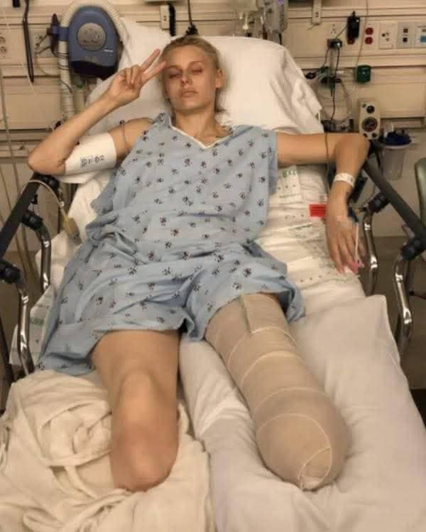 Her legs are.