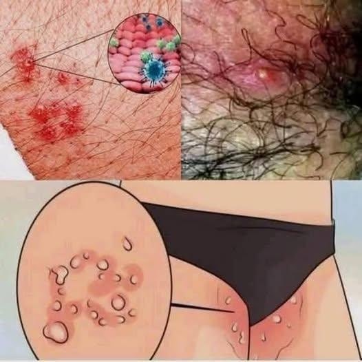 These are th.