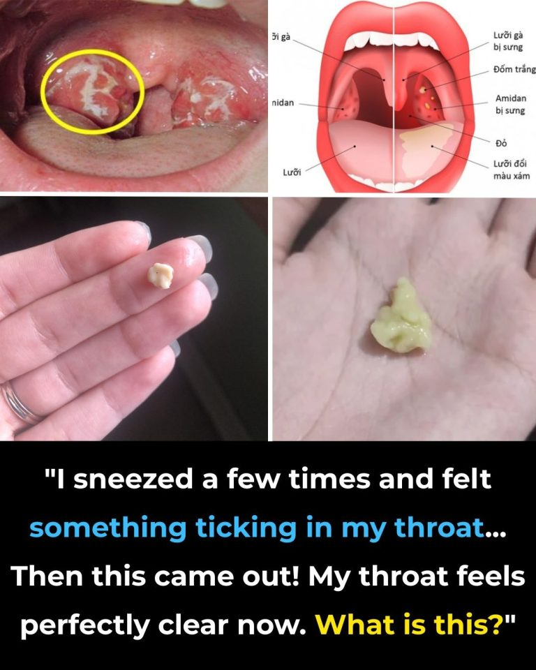 Here’s What You Need To Know About ……